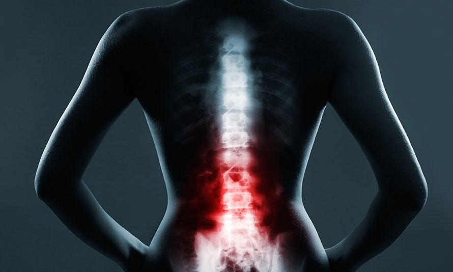 NYC Personal Injury Attorney