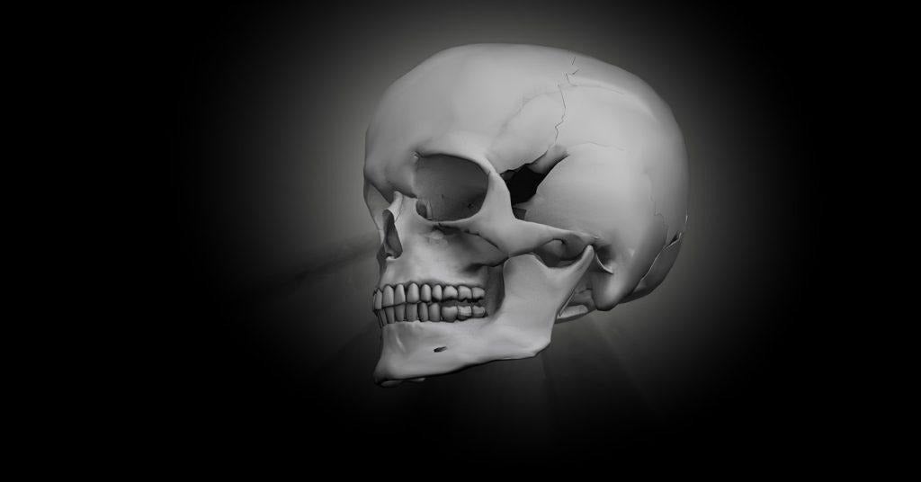 Diagnosing Skull Fracture After an Automobile Accident in Brooklyn, New York