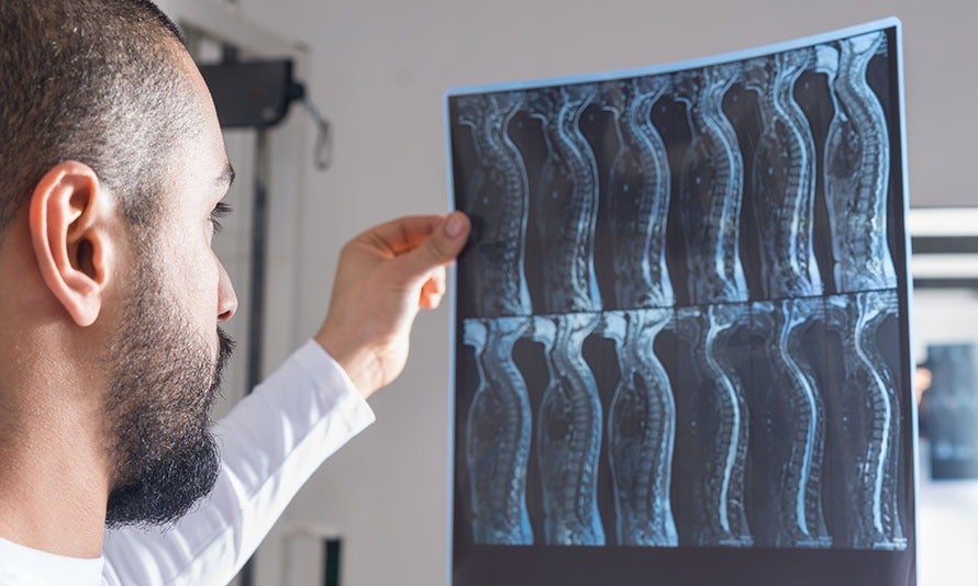Brooklyn Car Accident Lawyer: Whiplash Injury Claims in NY