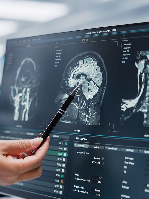 Hand pointing with a pen at a computer screen showing a brain MRI scan and medical data.